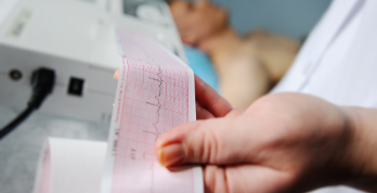 Electrocardiogram,,Ecg,In,Hand.,Clinic,Of,Cardiology,Heart,Rate,And