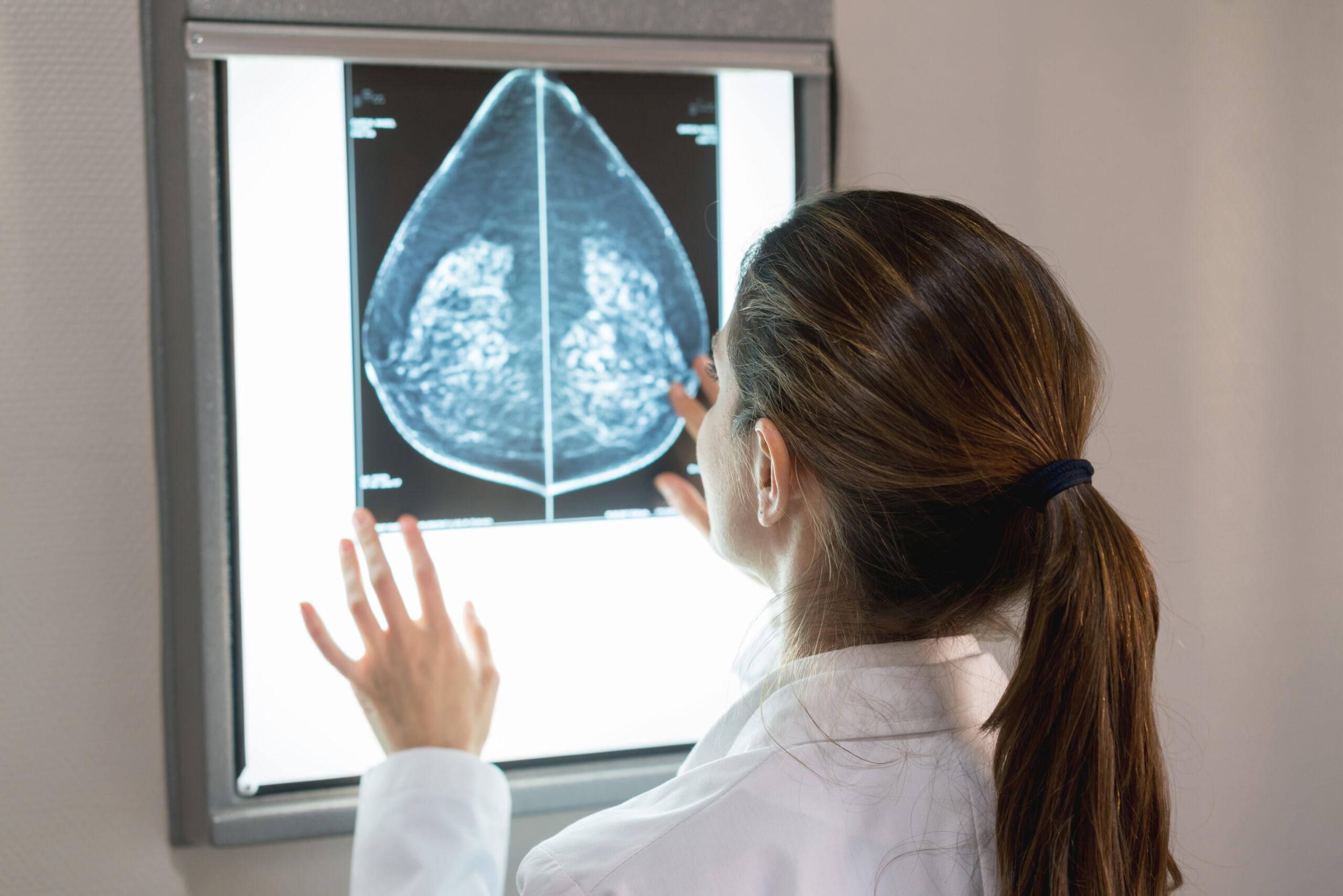 What Does It Mean to Have Dense Breasts? What Does It Mean to Have Dense Breasts?