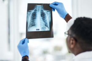 Physician examining lung scan for COPD