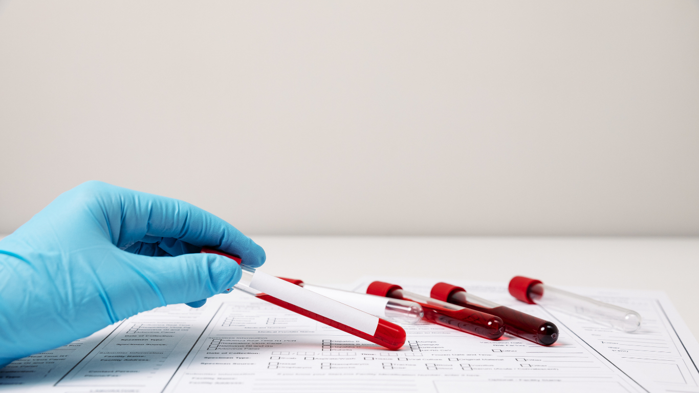 Routine Blood Tests West Tennessee Medical Group Primary Care
